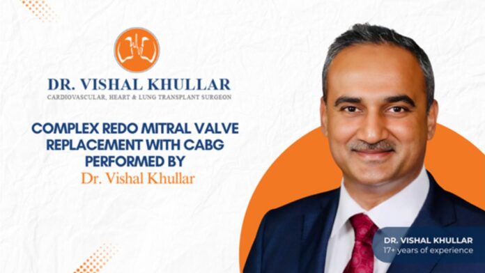 Dr. Vishal Khullar,heart bypass surgery,Redo Mitral Valve Replacement